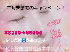 2月末までです!|キャンペーン情報