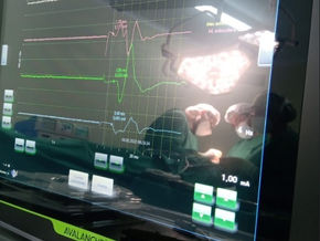 Monitorización del Nervio Facial : Tumor en la glándula parótida