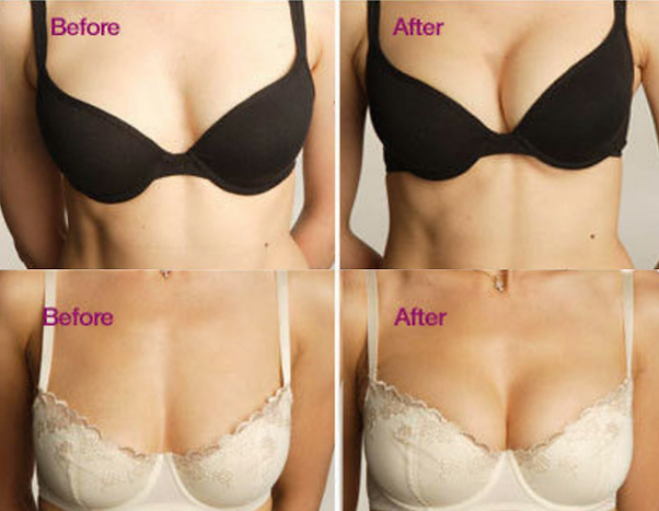 erectile dysfunction, mens clinic, ed clinic, federal workers compensation, weight loss, botox, virginia beach