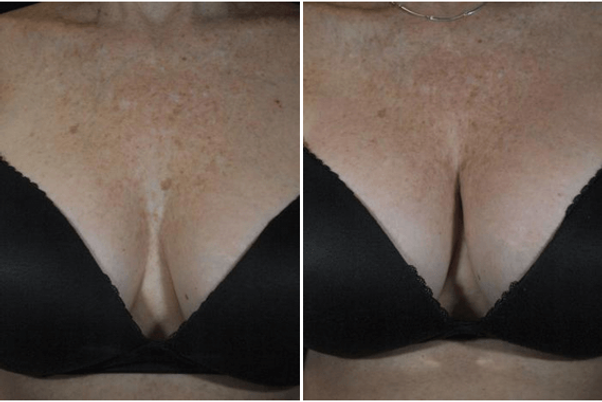 erectile dysfunction, mens clinic, ed clinic, federal workers compensation, weight loss, botox, virginia beach