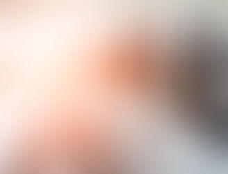 Hypertrofie. Do's and don'ts