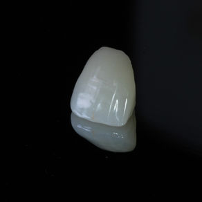 A Importância das próteses dentárias