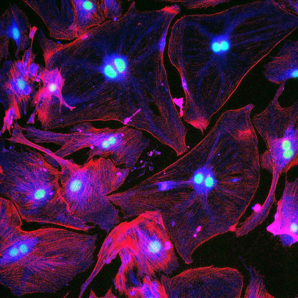 Senescent cells couv