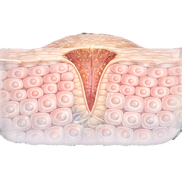 Wound-healing-light_edited_edited.png