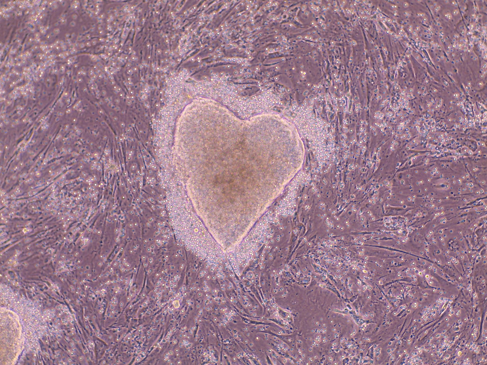 coeur de cellules vu au microscope