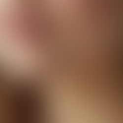 How Skin Tightening Improves Skin Elasticity