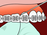flossing_31.gif