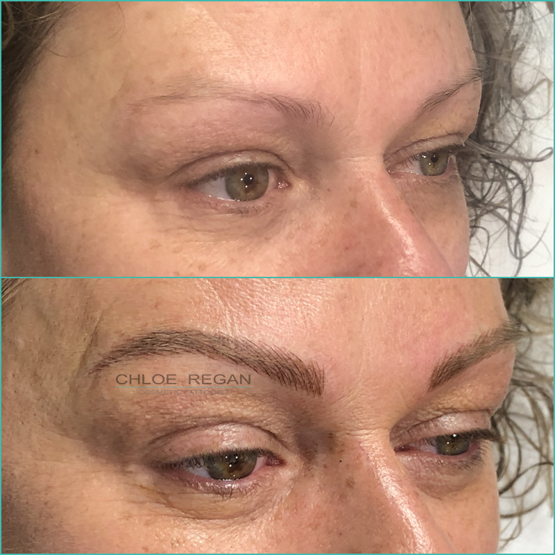 Eyebrow Cosmetic Tattoo