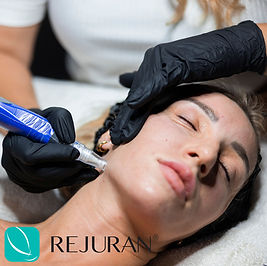 Rejuran Skin Booster treatment being performed with SkinPen microneedling to support skin hydration, repair and overall skin quality.