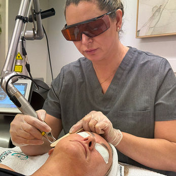 skin pico laser toning targeting pigmentation, melasma and skin rejuvenation