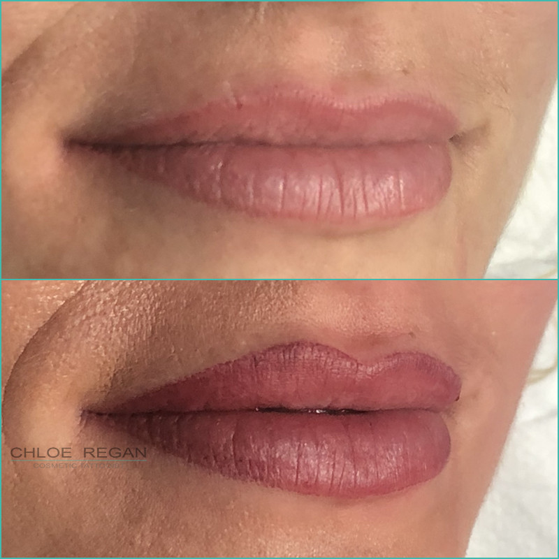 Lip Cosmetic tattoo