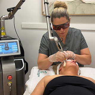 Laser treatment for facial pigmentation using the SKN Pico Premium™ device at the Chloe Regan Cosmetic Clinic, Noosa.