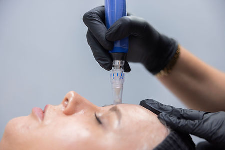 Microneedling skin rejuvenation with SkinPen at Chloe Regan Cosmetic Clinic — expert non-surgical treatment in Noosa, Sunshine Coast targeting texture, tone, and fine lines.