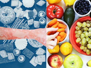 Explorând legătura dintre psoriazis și alimentele cu potențial histaminic mai mare 🌿✨