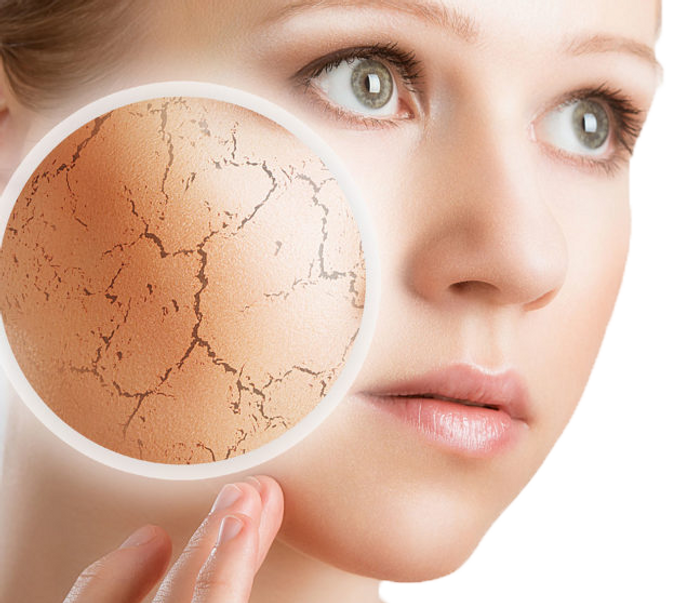 Winter Skin copy.png