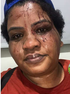 INFLUENCIADORA KIKA SOUZA É VÍTIMA DE VIOLENTA AGRESSÃO E OFENSAS RACIAIS EM FRENTE A BAR NA VILA MARGARIDA