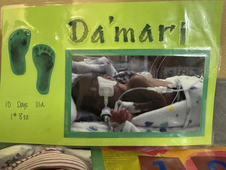 One pound and seven ounces: Baby born at 23 weeks home again after months in hospital