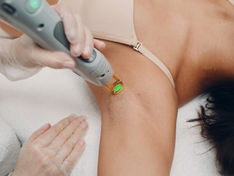 Laser Hair Removal Redlands