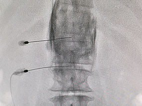 220120 CPN,SMN 7西 星 道明 (7)_edited.jpg