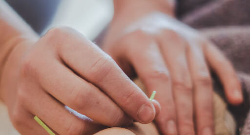 Chiropractor applying accupuncture on patient