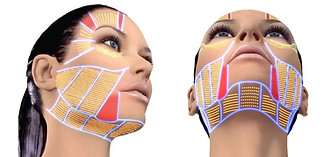 3D HIFU Facelift
