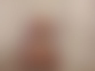 Pierścień z futra na penisie u szynszyli 