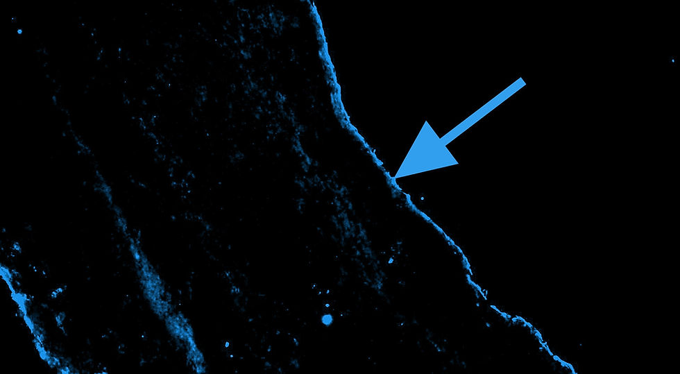Presto_explant_blue_arrow_cropped_brightened_20250613_CD31(2)_10x 2_rgb_CH(Cy3)_CH2.jpg