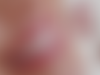 When Is the Appropriate Time to Consider Tooth Whitening After Orthodontic Treatment?