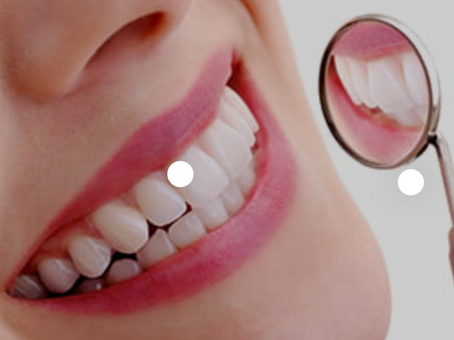When Is the Appropriate Time to Consider Tooth Whitening After Orthodontic Treatment?