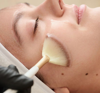 Ekseption peptide peel in Asheville NC