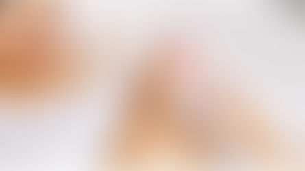 Elimina los granitos tras depilación