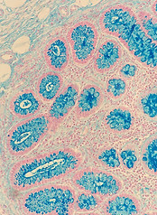 Colloidal Iron - 2_edited.jpg