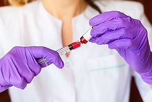 pink urine after b12 injection pink urine after vitamin b12 injection Pink urine after propofol anesthesia