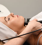 RF-treatment-4.jpg