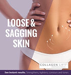 sagging-skin.jpg