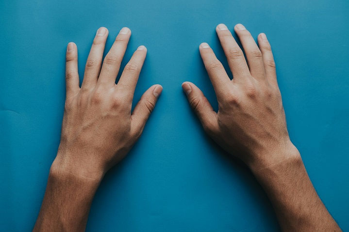 Rheumatoid Arthritis Autoimmune