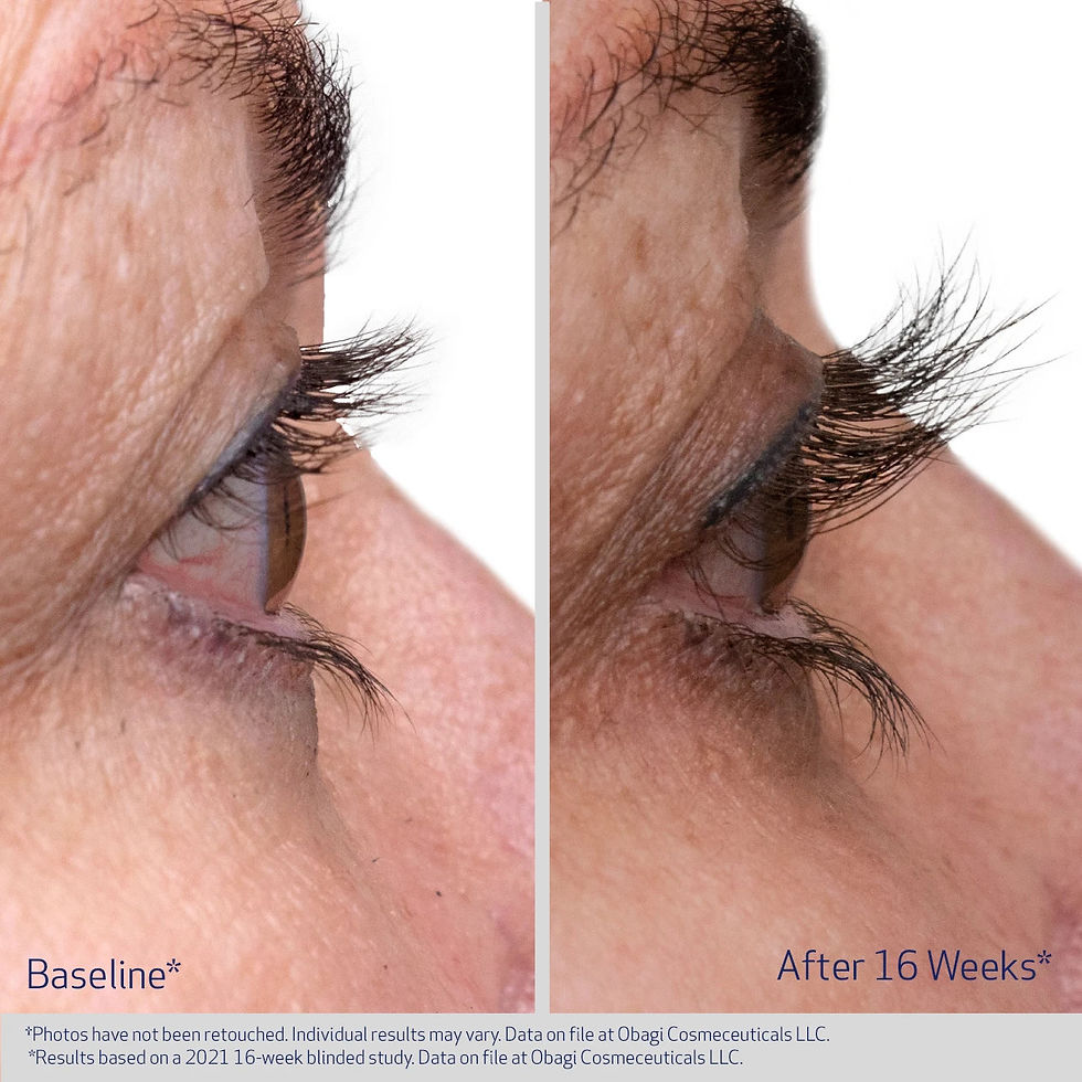 Thumbnail: Obagi Nu-Cil Eyelash Enhancing Serum