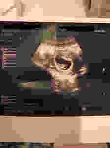 image2 (2)