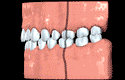 1-spacing.webp