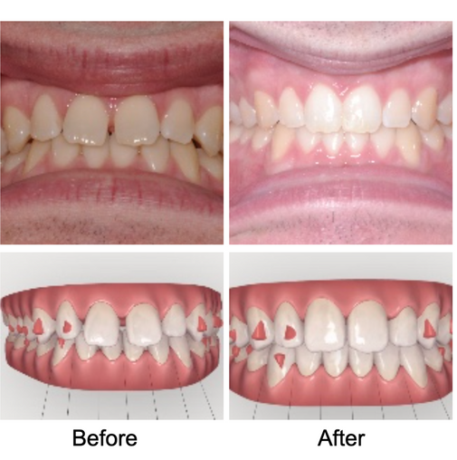 Orthodontist Lititz PA Lititz Orthodontics Clear Braces