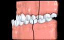 3-skeletal.webp