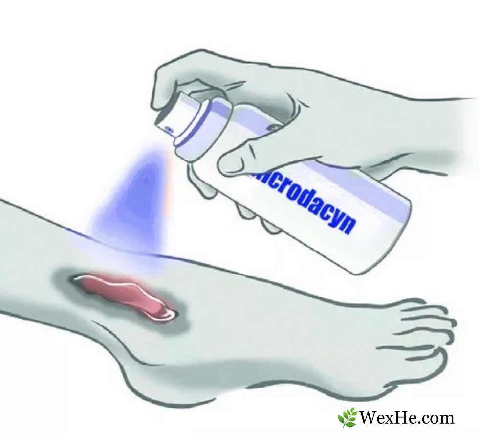 Thumbnail: MICRODACYN ANTISEPTIC & DISINFECTANT SPRAY DIABETIC SKIN & WOUND CARE 9/2023