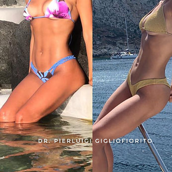lipo.JPEG