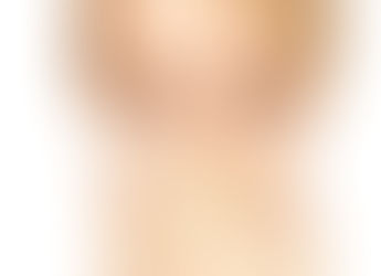 Laryngitis, Hoarseness and Vocal Blowout