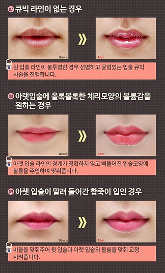 입술3.jpg