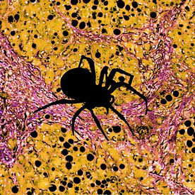 State of The Virus - Big Pharma Goes Nuts over NASH. Plus: Pot, Zinc and Green Tea
