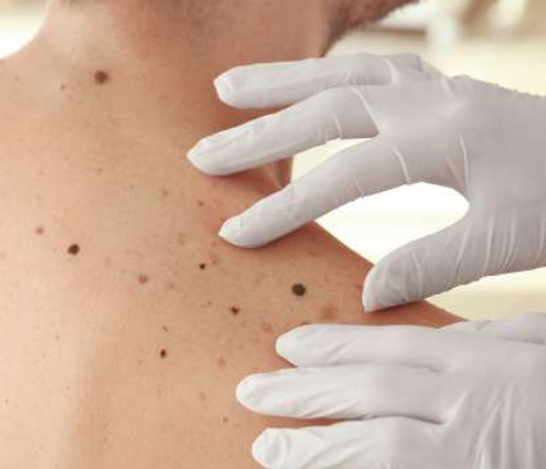 Skin-Cancer-Banner.jpg