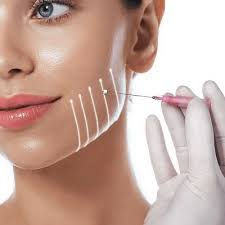 What Are the Benefits of Thread Lift Treatment?