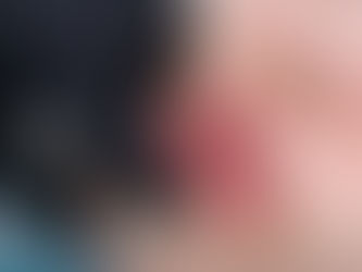 Are Russian Lip Fillers Trendy in 2025?