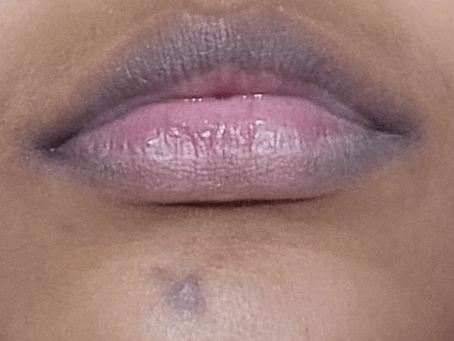 What Is the Typical Price Range for Smoker’s Lips Treatment?